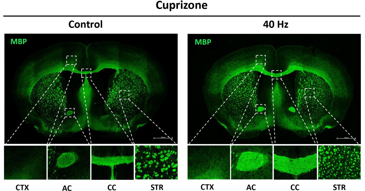 Study reveals ways in which 40Hz sensory stimulation may